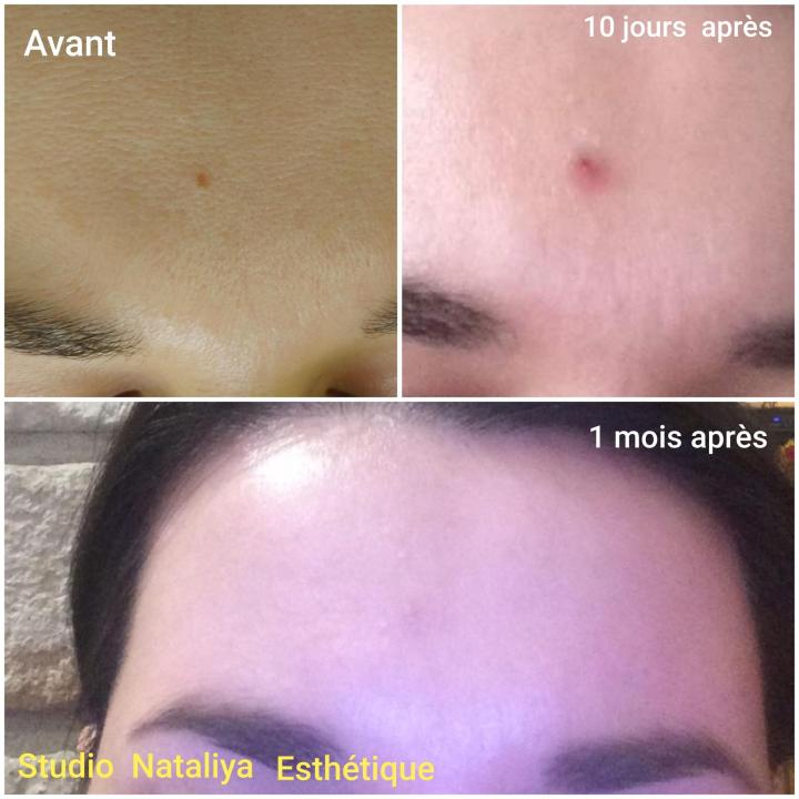 Soins du corps Lasalle