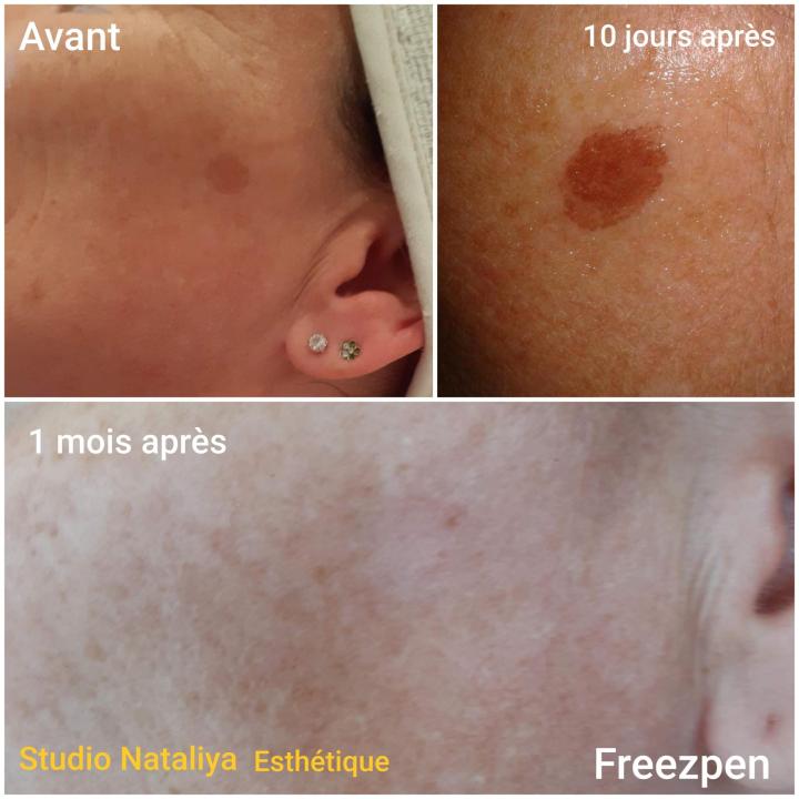 Spécialiste en soins du visage Lasalle