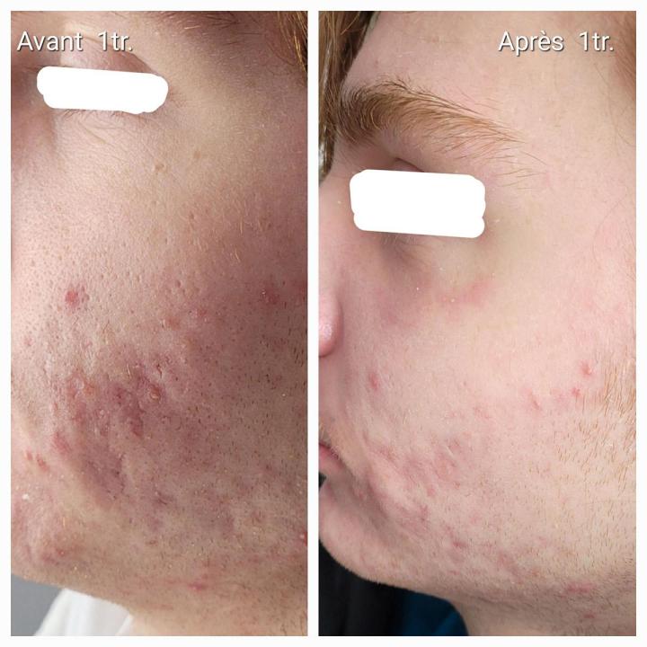 Soins du corps Lasalle