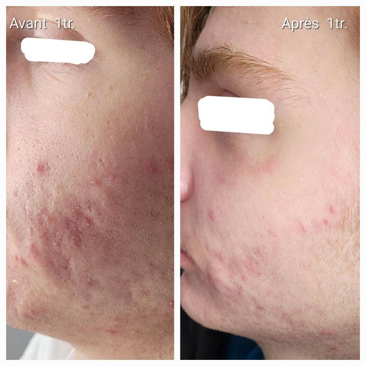 Soins médico-esthétique Lasalle