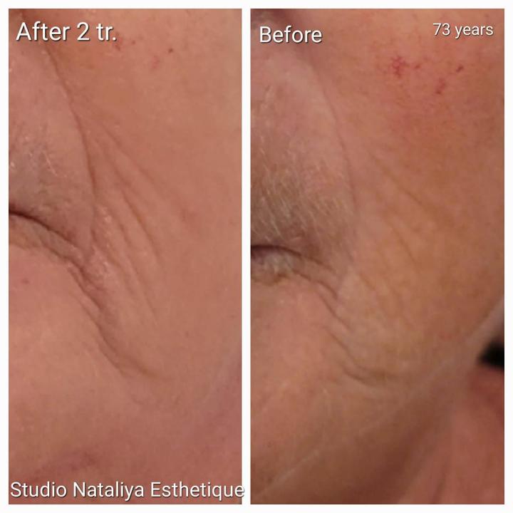 Soins médico-esthétique Lasalle