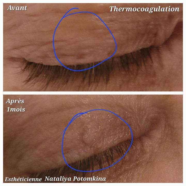 Spécialiste en soins du visage Lasalle